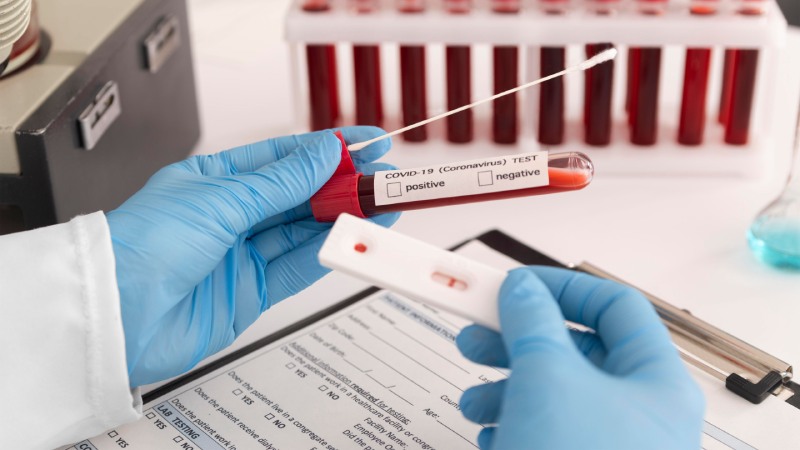 chẩn đoán gan nhiễm mỡ độ 2