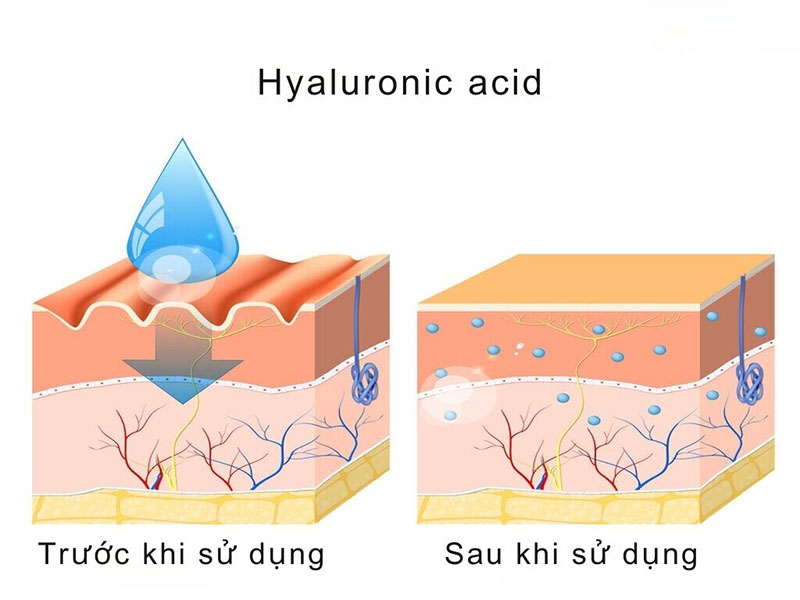 Tác dụng của axit Hyaluronic đối với da