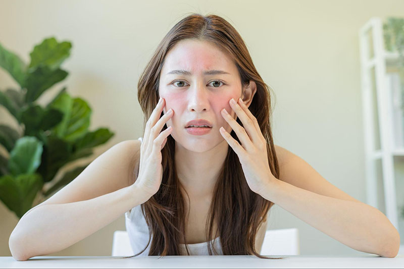 Lòng trắng trứng gà làm diệu da bị cháy nắng