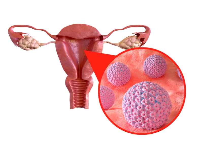 virus hpv gây ra bệnh lý niêm mạc của bộ phận sinh dục