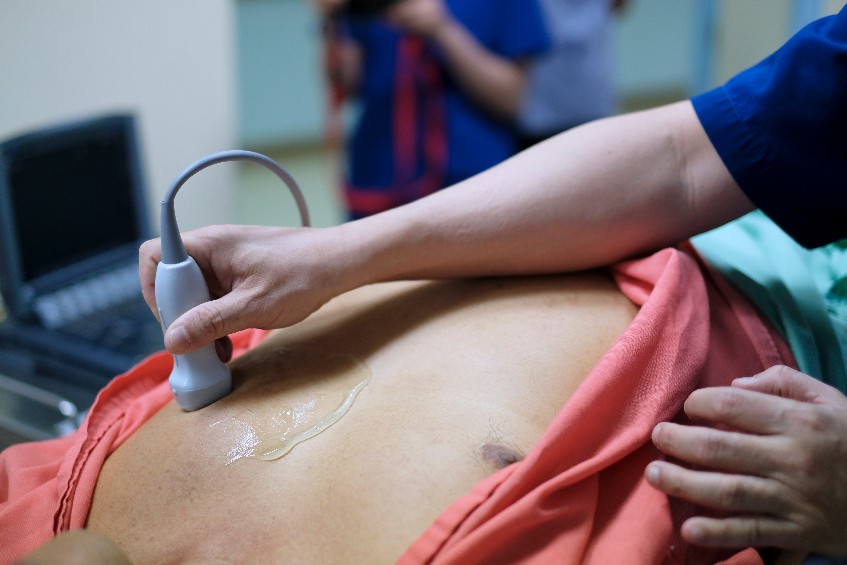 chẩn đoán nhồi máu cơ tim bằng siêu âm tim