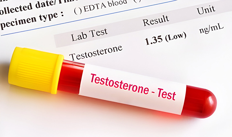 Chẩn đoán tình trạng suy giảm testosterone