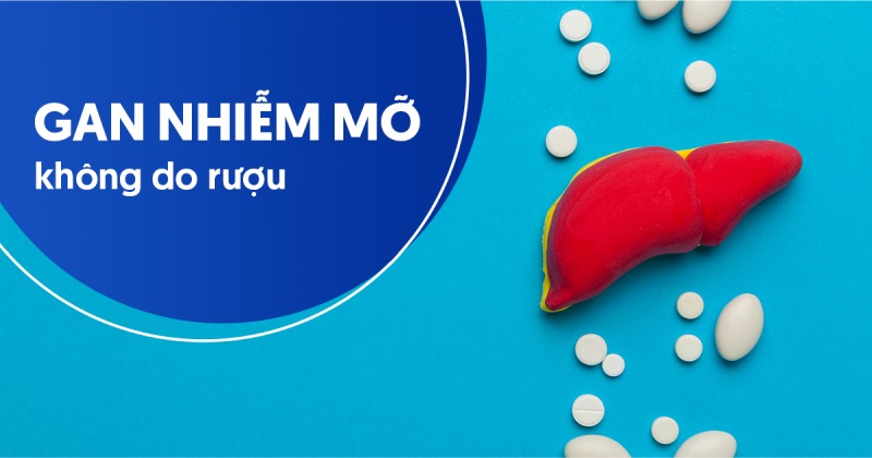 gan nhiễm mỡ không do rượu
