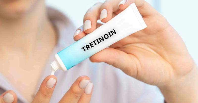 mọc tóc bằng tretinoin
