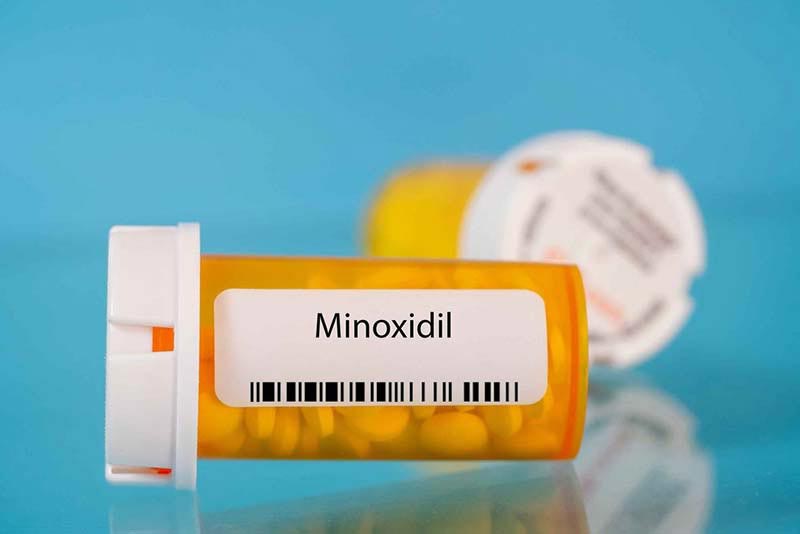 Minoxidil điều trị rụng tóc ở nam giới