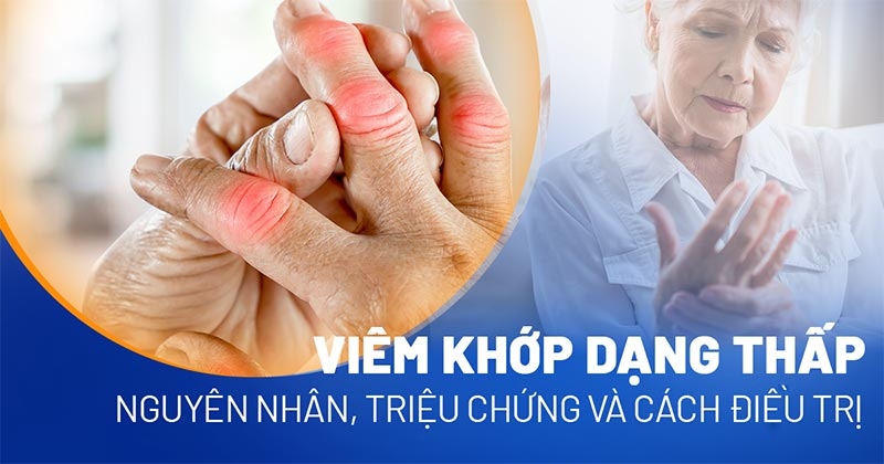Bệnh viêm khớp dạng thấp