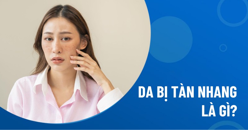 Da bị tàn nhang là gì