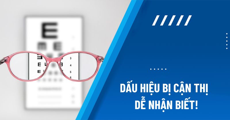 dấu hiệu bị cận thị