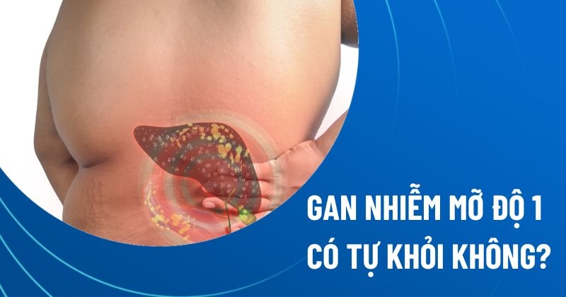 gan nhiễm mỡ độ 1 có tự khỏi không