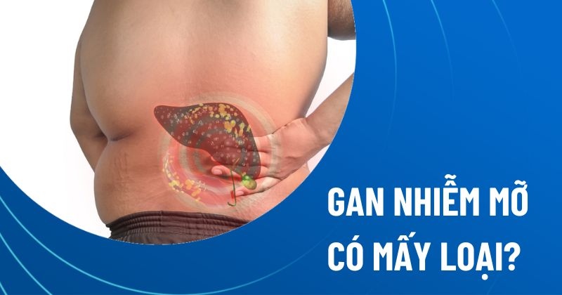 gan nhiễm mỡ có mấy loại
