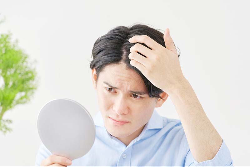nam giới bị rụng tóc sớm