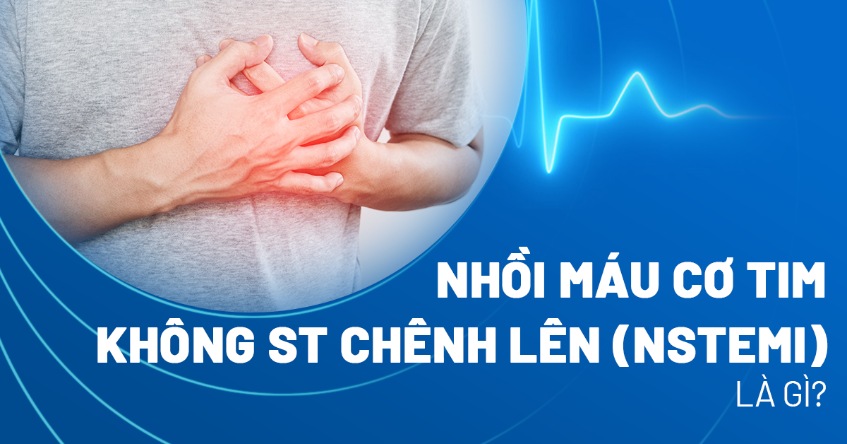 Nhồi máu cơ tim không ST chênh lên (NSTEMI): Chẩn đoán và điều trị