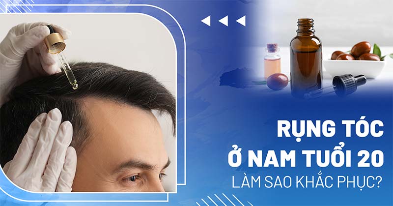 rụng tóc ở nam tuổi 20
