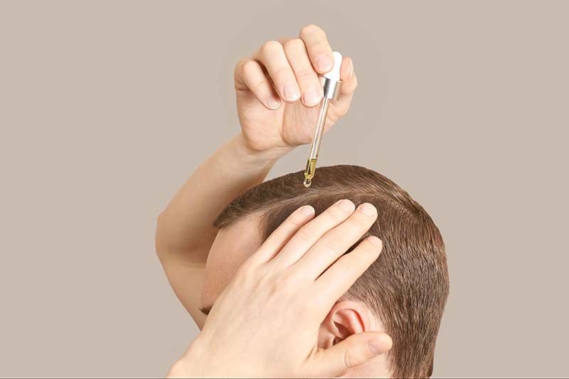sử dụng thuốc bôi ngoài chữa rụng tóc