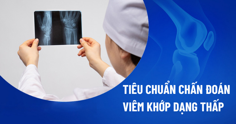 Tiêu chuẩn chẩn đoán viêm khớp dạng thấp