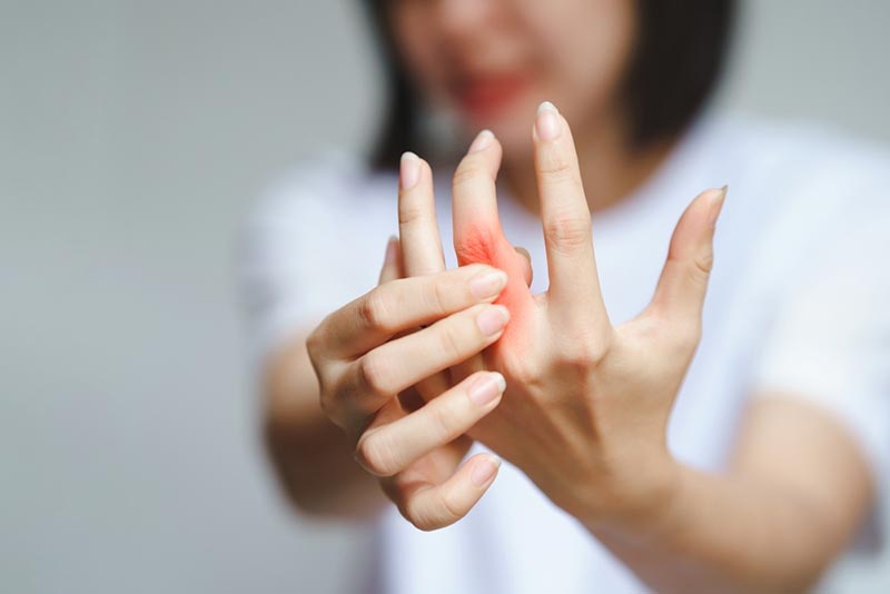 Viêm khớp dạng thấp là bệnh thường gặp