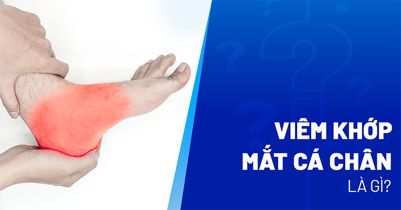 Viêm khớp mắt cá chân