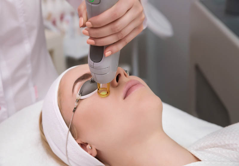 Bắn laser giúp loại bỏ đồi mồi trên da hiệu quả Bắn laser giúp loại bỏ đồi mồi trên da hiệu quả