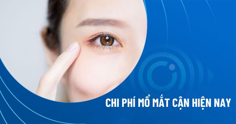 Chi phí mổ mắt cận thị bao nhiêu tiền