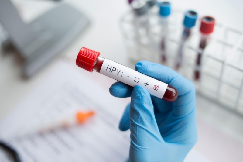 có thể xét nghiệm hpv ở nam giới
