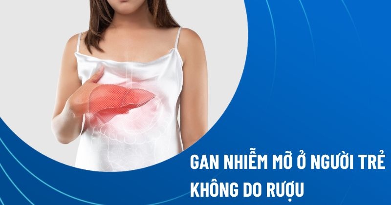 gan nhiễm mỡ ở người trẻ không do rượu