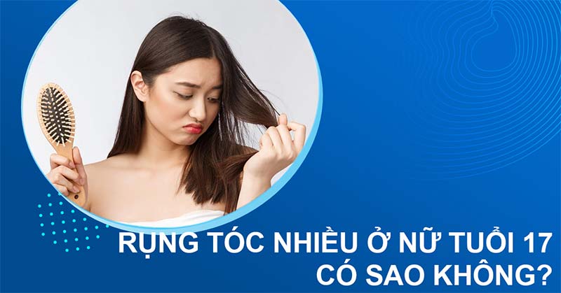 rụng tóc nhiều ở nữ tuổi 17 có sao không