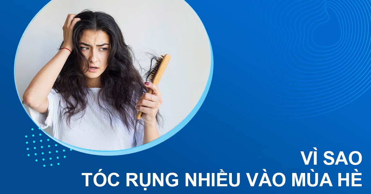 tóc rụng nhiều vào mùa hè