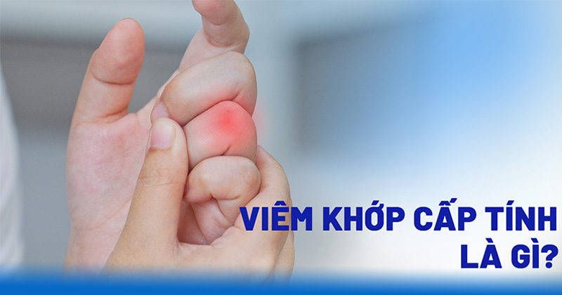 Viêm khớp cấp tính