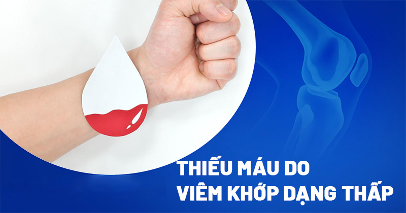 Viêm khớp dạng thấp gây thiếu máu