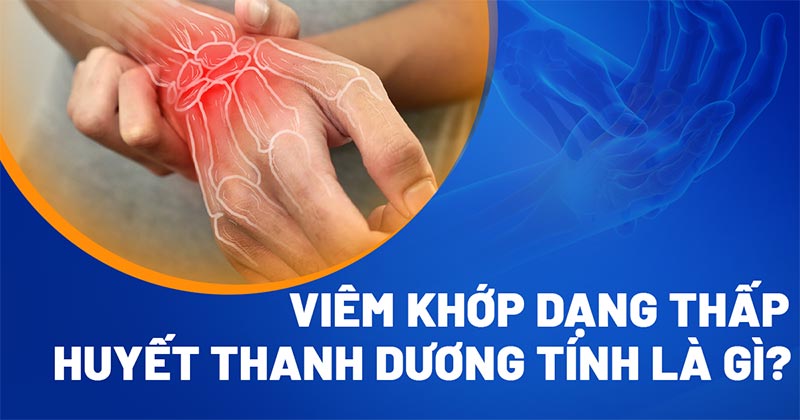Viêm khớp dạng thấp huyết thanh dương tính