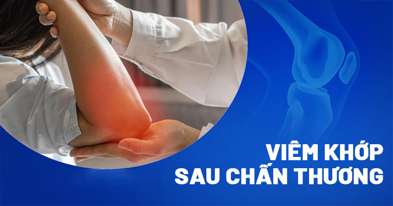Viêm khớp sau chấn thương
