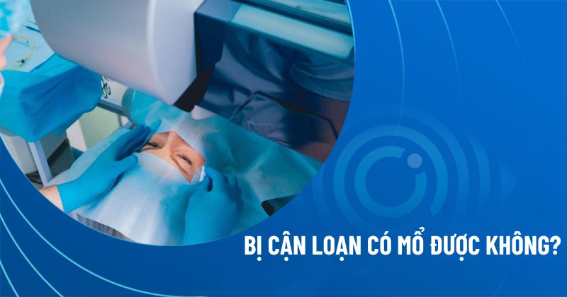 Bị cận loạn có mổ được không
