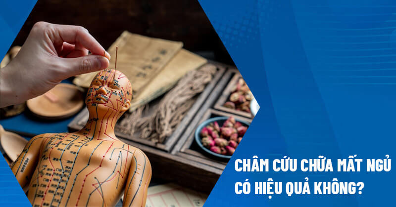 Châm cứu chữa mất ngủ có hiệu quả không?