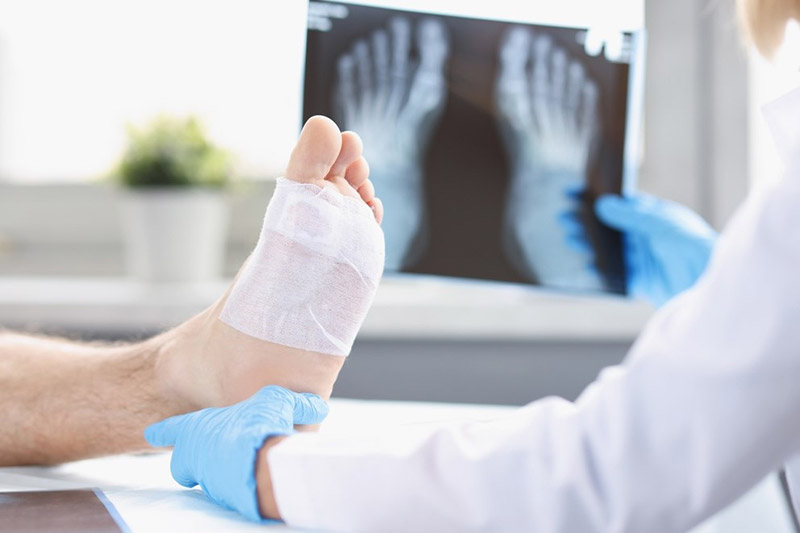 Chấn thương gây viêm khớp ngón chân