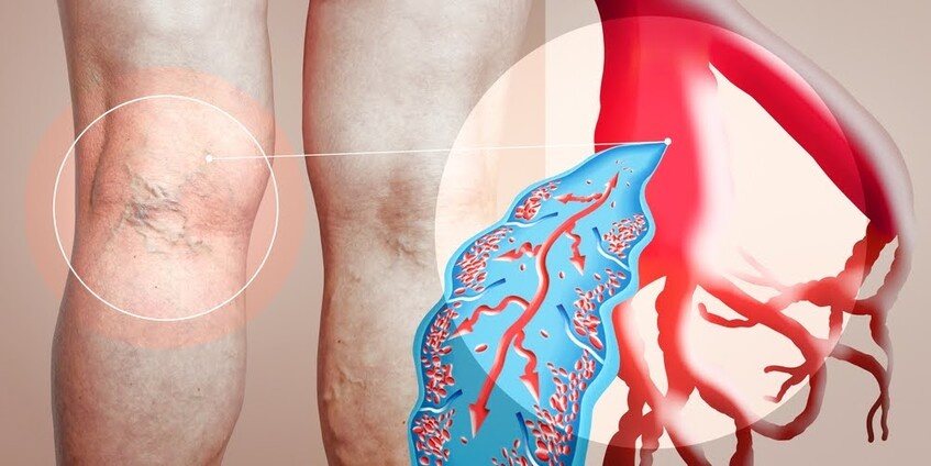 điều trị nhịp chậm