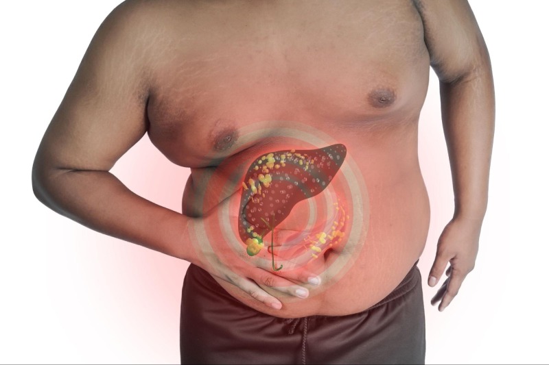 gan nhiễm mỡ cấp độ 1 có nguy hiểm không