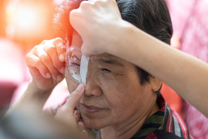 Mổ mắt cận loạn có tác dụng phụ không?