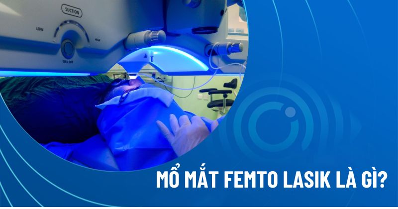 Mổ mắt Femto Lasik