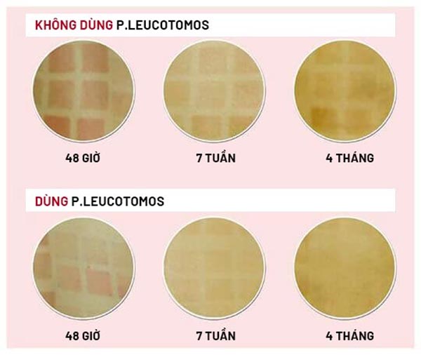So sánh hiệu quả khi dùng P.Leucotomos