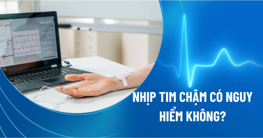 Nhịp tim chậm có nguy hiểm không? Các biến chứng có sao không?