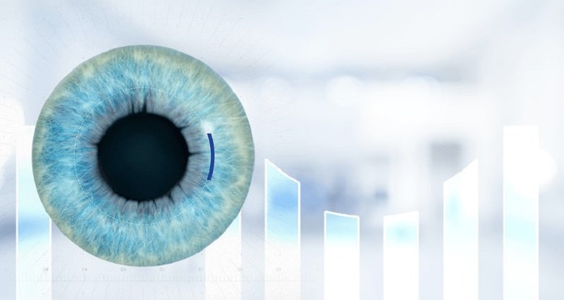 Phương pháp ReLEx Smile