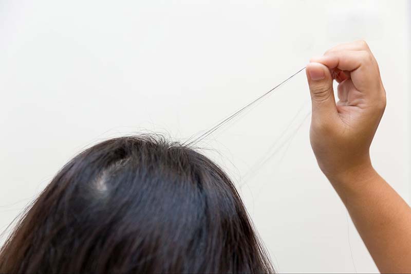 tật nghiện nhổ tóc