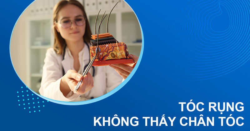 tóc rụng không thấy chân tóc