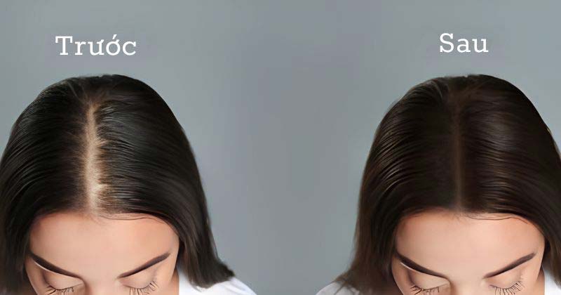 Những người nên sử dụng dầu gội đầu hà thủ ô Những người nên sử dụng dầu gội đầu hà thủ ô