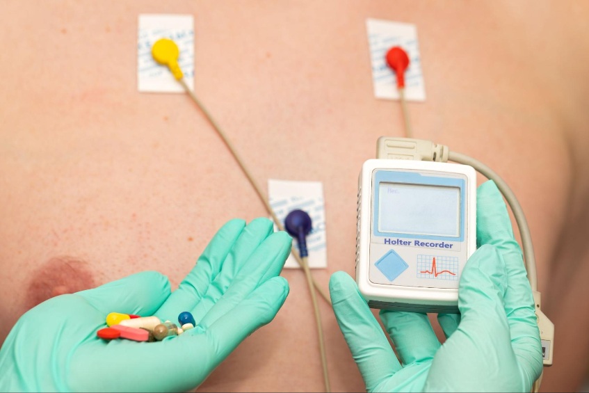 chẩn đoán nhịp nhanh nhĩ