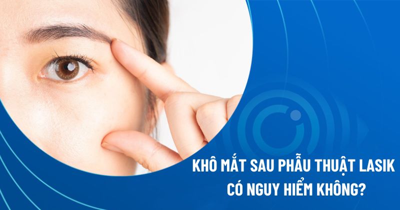 Khô mắt sau phẫu thuật Lasik có nguy hiểm không?