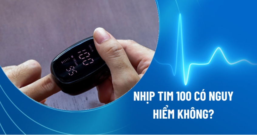 Nhịp tim 100 có nguy hiểm không? Biến chứng và cách cải thiện