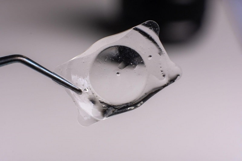 Phương pháp phẫu thuật PHAKIC dành cho người giác mạc mỏng