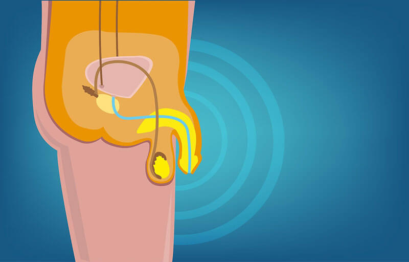 Tiểu đường làm giảm nồng độ nitric oxide