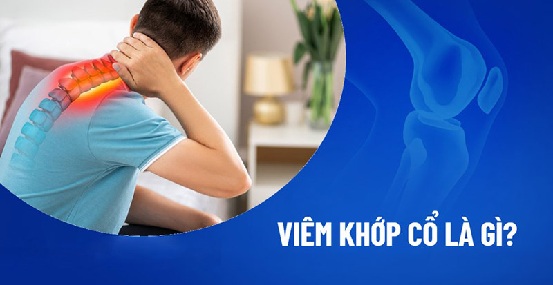 Viêm khớp cổ
